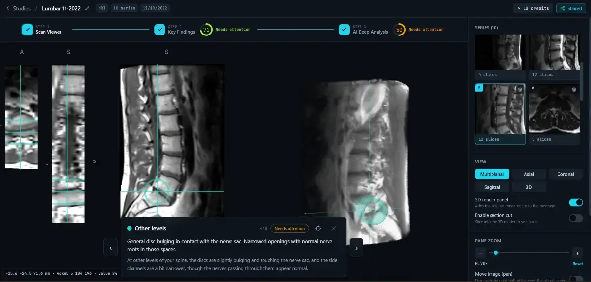 Read Your Scan screenshot 2